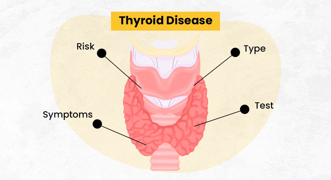 types of thyroid, thyroid treatment, thyroid symptoms in female